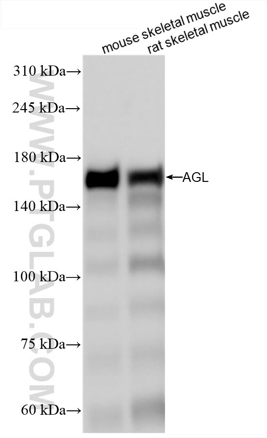 Western Blot (WB) analysis of various lysates using AGL Recombinant antibody (86187-1-RR)