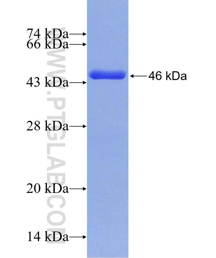 AGL fusion protein Ag29640 SDS-PAGE