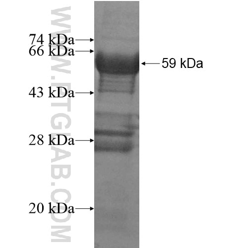 AGMAT fusion protein Ag13609 SDS-PAGE