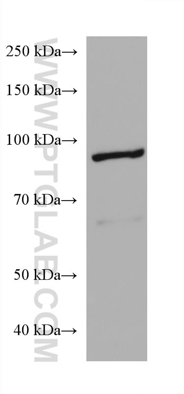 Western Blot (WB) analysis of 4T1 cells using AGO2 Monoclonal antibody (67934-1-Ig)