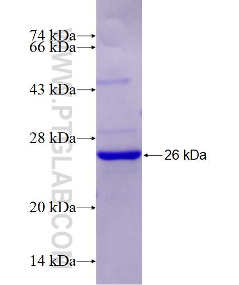 AGO2 fusion protein Ag27772 SDS-PAGE