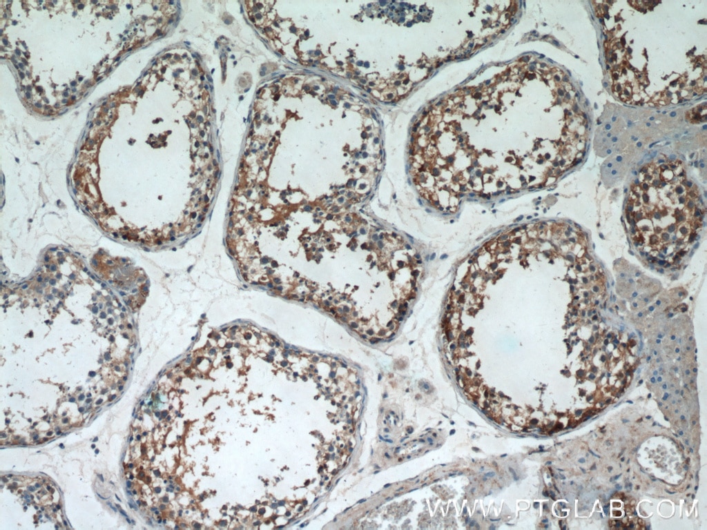 Immunohistochemistry (IHC) staining of human testis tissue using AGPAT1 Polyclonal antibody (10601-1-AP)
