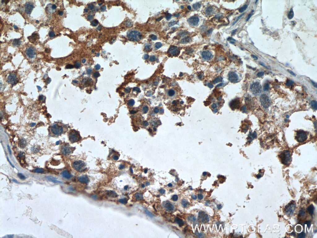 Immunohistochemistry (IHC) staining of human testis tissue using AGPAT1 Polyclonal antibody (10601-1-AP)