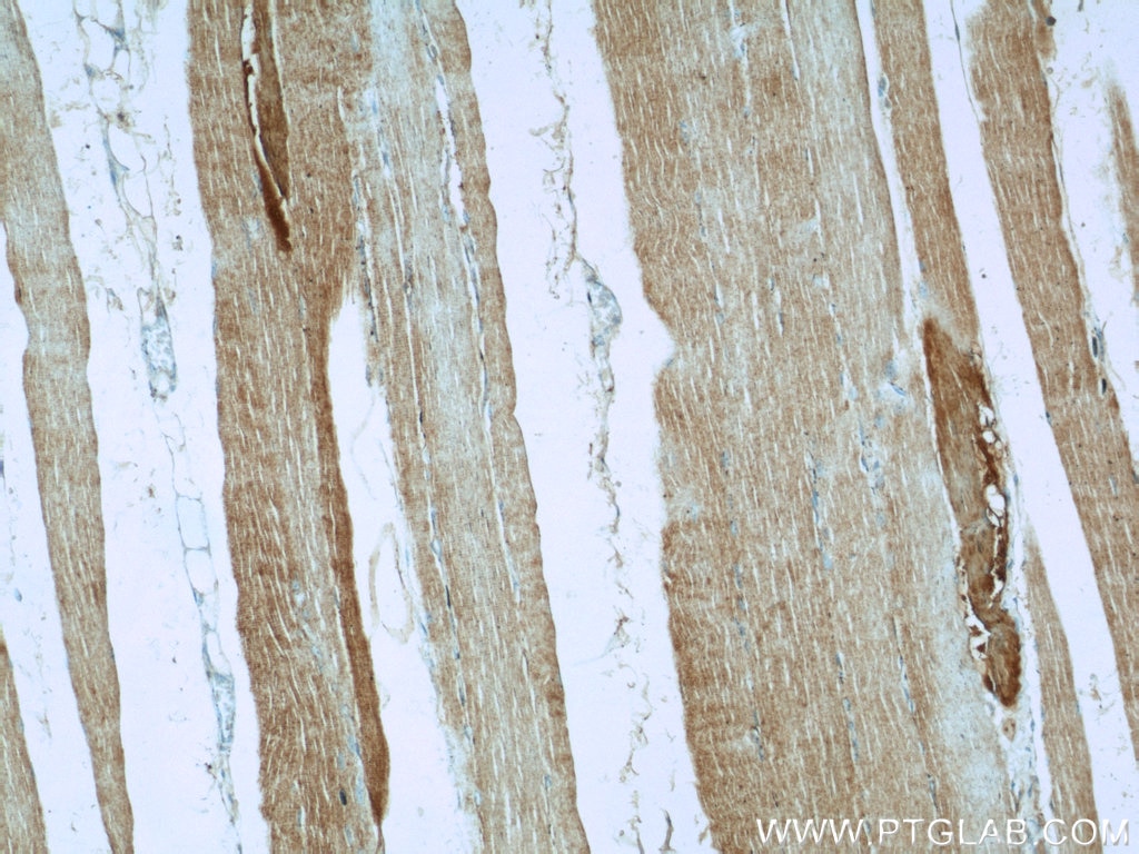 IHC staining of human skeletal muscle using 10601-1-AP