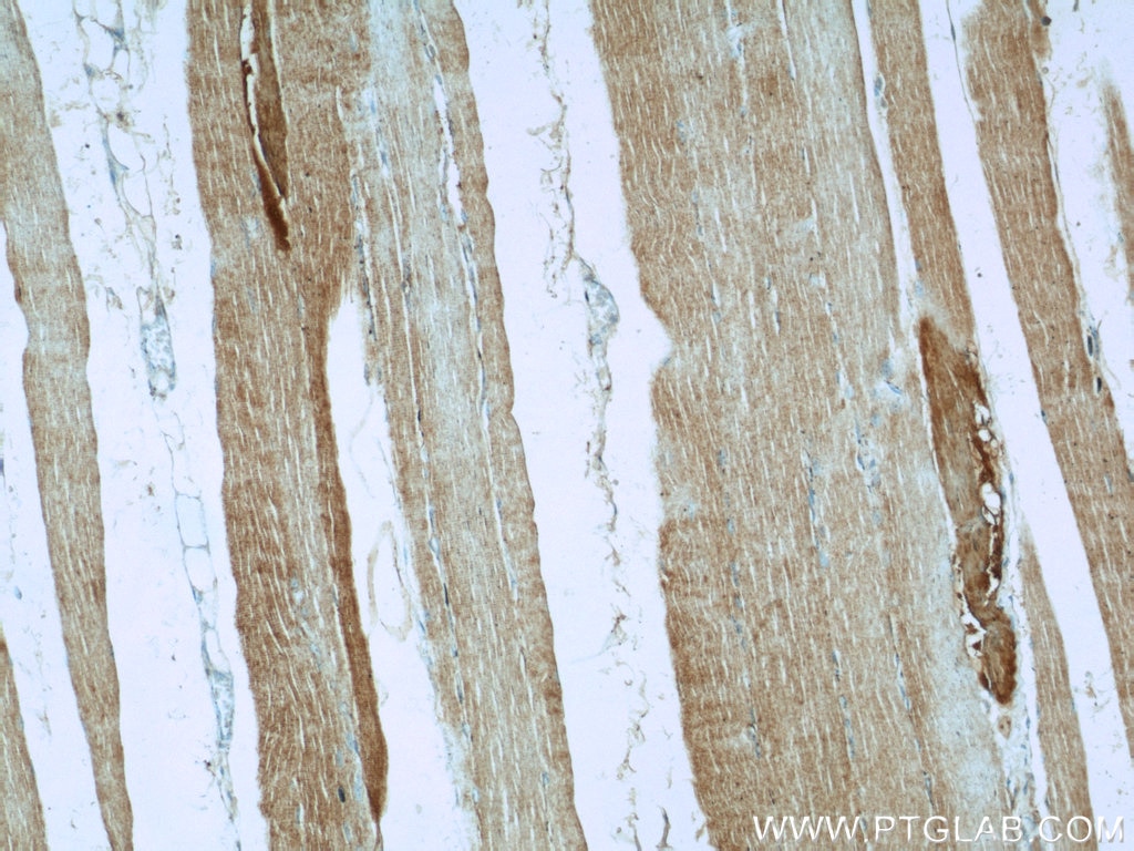 Immunohistochemistry (IHC) staining of human skeletal muscle tissue using AGPAT1 Polyclonal antibody (10601-1-AP)