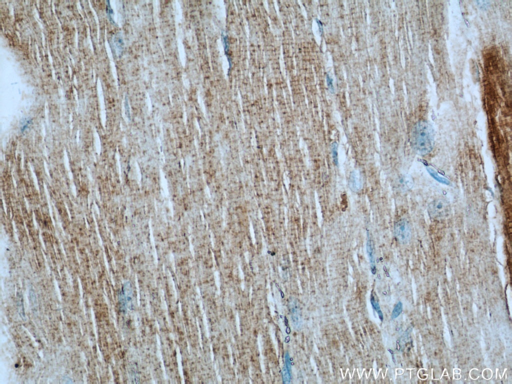 Immunohistochemistry (IHC) staining of human skeletal muscle tissue using AGPAT1 Polyclonal antibody (10601-1-AP)