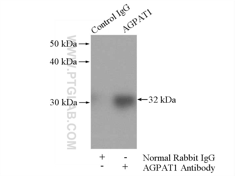 Immunoprecipitation (IP) experiment of Raji cells using AGPAT1 Polyclonal antibody (10601-1-AP)