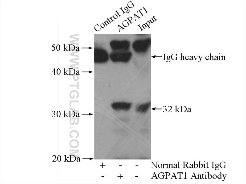 Immunoprecipitation (IP) experiment of mouse skeletal muscle tissue using AGPAT1 Polyclonal antibody (10601-1-AP)