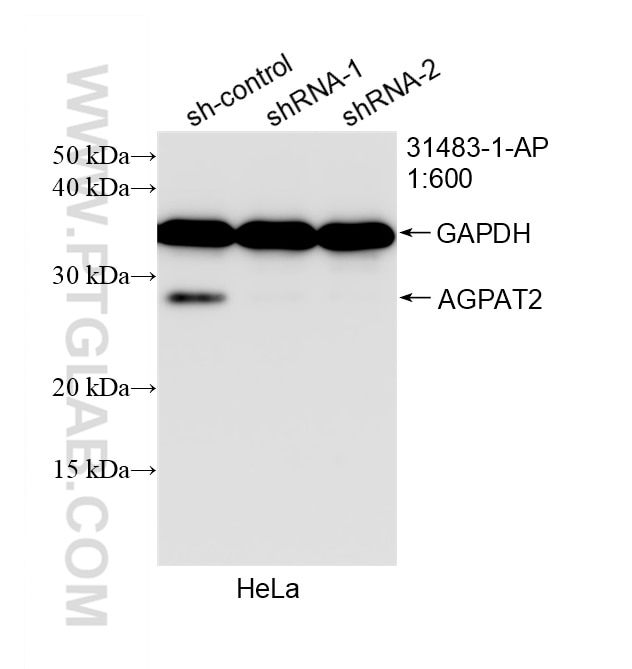 WB analysis of HeLa using 31483-1-AP Western Blot (WB) analysis of HeLa cells using AGPAT2 Polyclonal antibody (31483-1-AP)