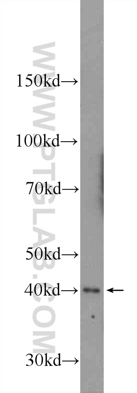 Western Blot (WB) analysis of rat testis tissue using AGPAT3 Polyclonal antibody (25723-1-AP)