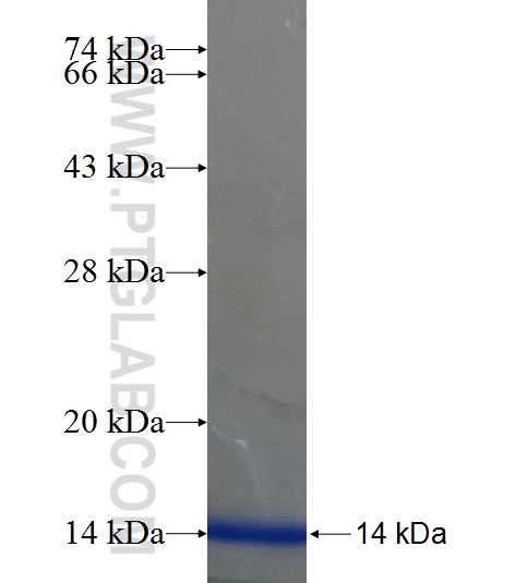 AGPAT3 fusion protein Ag22855 SDS-PAGE