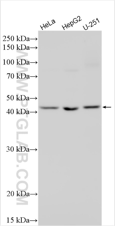 Western Blot (WB) analysis of various lysates using AGPAT4 Polyclonal antibody (16562-1-AP)