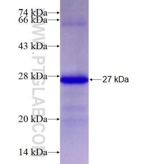 AGPAT5 fusion protein Ag27782 SDS-PAGE