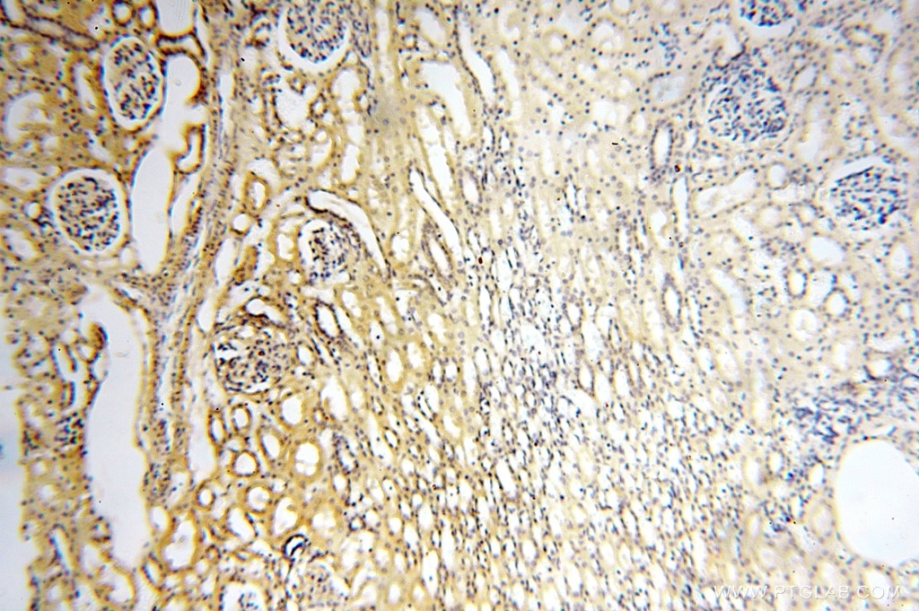 IHC staining of human kidney using 16762-1-AP