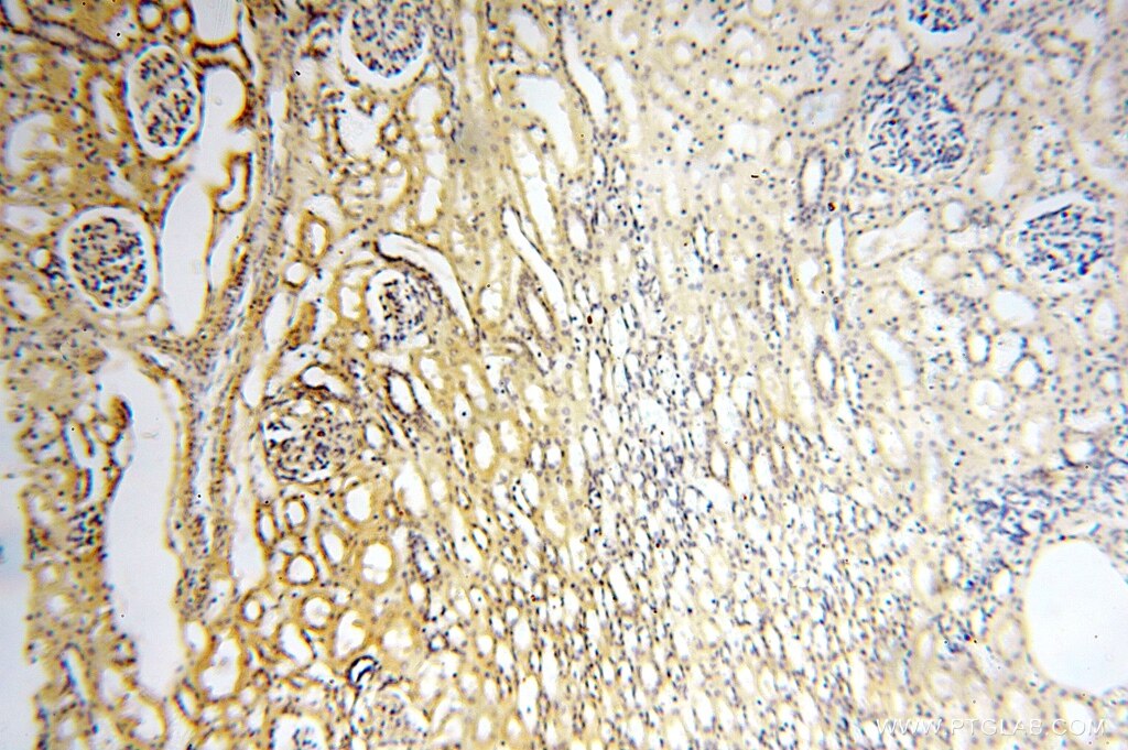 Immunohistochemistry (IHC) staining of human kidney tissue using AGPAT6 Polyclonal antibody (16762-1-AP)