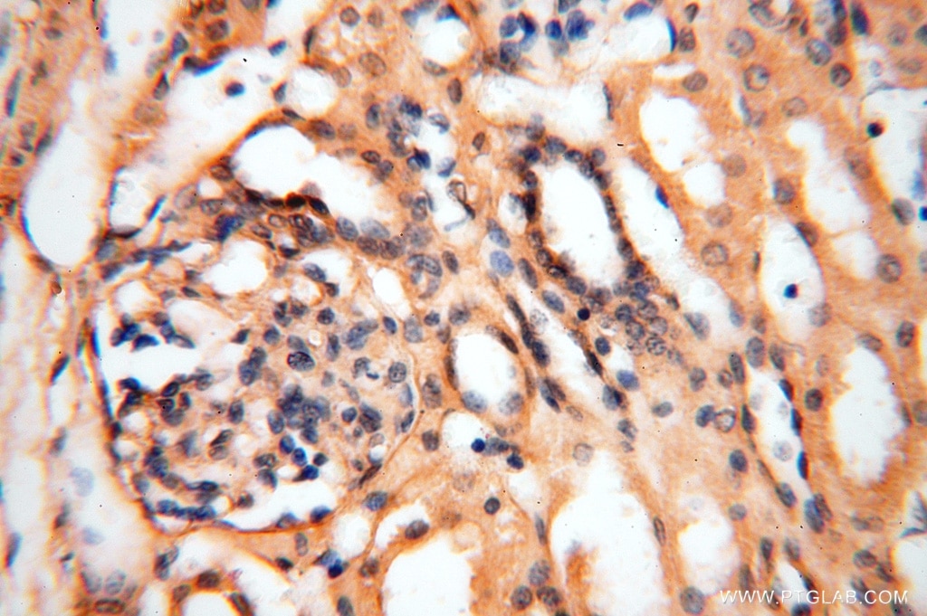 Immunohistochemistry (IHC) staining of human kidney tissue using AGPAT6 Polyclonal antibody (16762-1-AP)