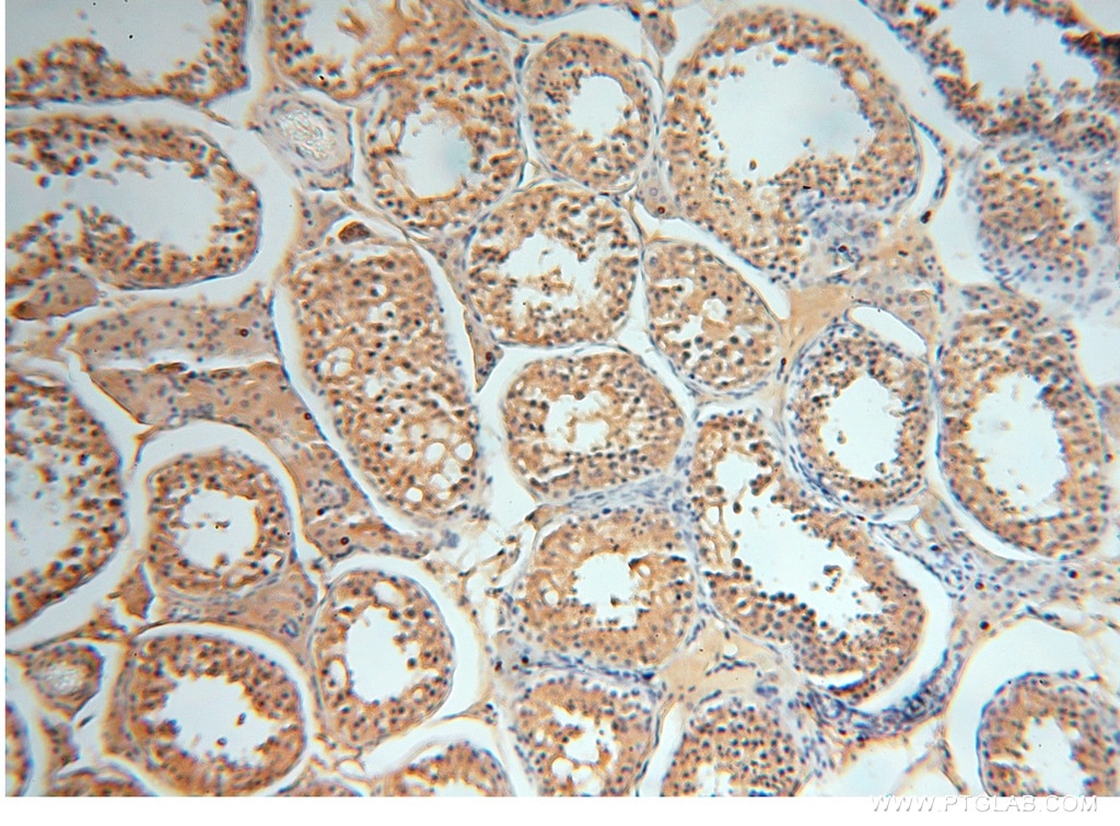 Immunohistochemistry (IHC) staining of human testis tissue using AGPAT6 Polyclonal antibody (16762-1-AP)