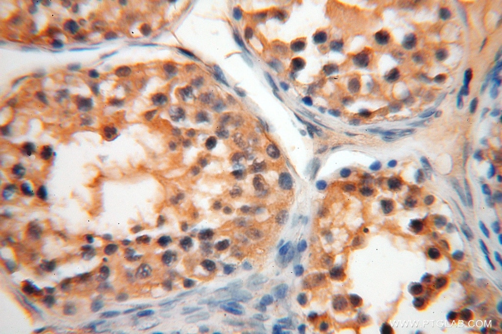 Immunohistochemistry (IHC) staining of human testis tissue using AGPAT6 Polyclonal antibody (16762-1-AP)