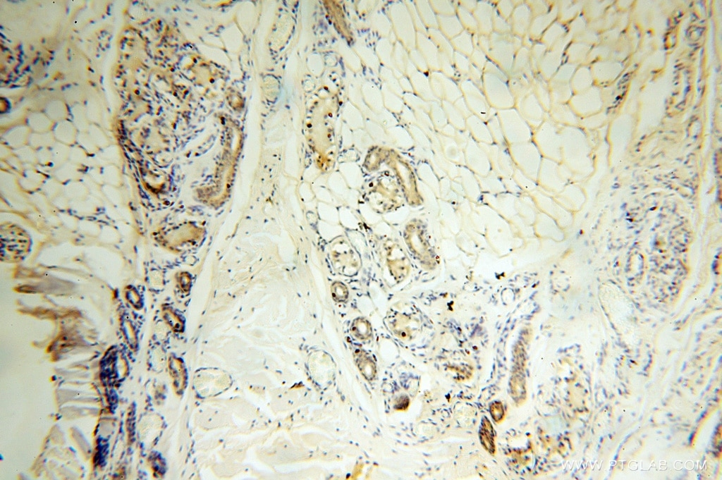 Immunohistochemistry (IHC) staining of human skin tissue using AGPAT6 Polyclonal antibody (16762-1-AP)