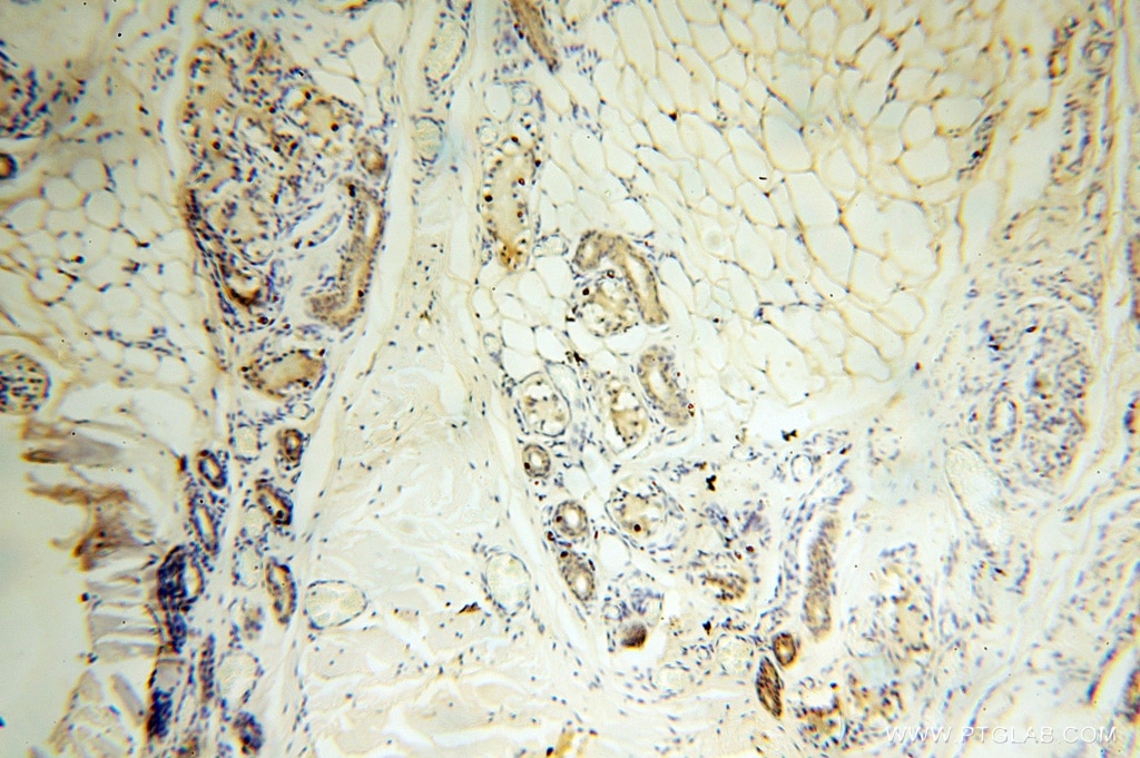 IHC staining of human skin using 16762-1-AP