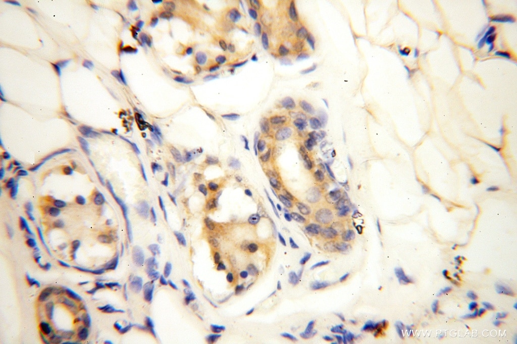 Immunohistochemistry (IHC) staining of human skin tissue using AGPAT6 Polyclonal antibody (16762-1-AP)