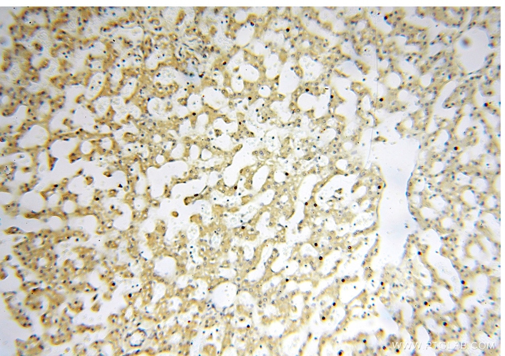 Immunohistochemistry (IHC) staining of human liver tissue using AGPAT6 Polyclonal antibody (16762-1-AP)