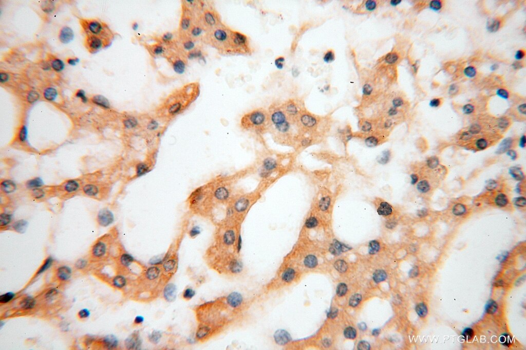 Immunohistochemistry (IHC) staining of human liver tissue using AGPAT6 Polyclonal antibody (16762-1-AP)