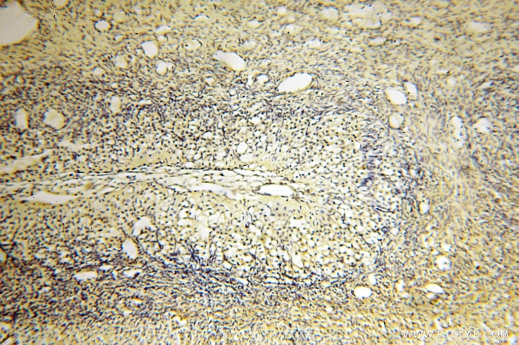 Immunohistochemistry (IHC) staining of human ovary tissue using AGPAT6 Polyclonal antibody (16762-1-AP)
