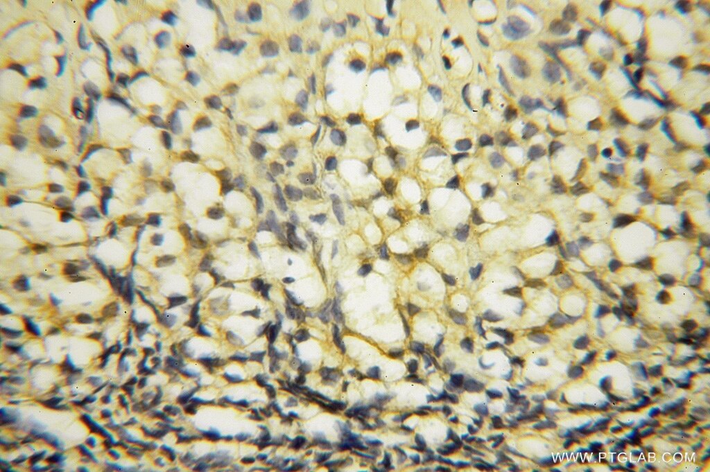 Immunohistochemistry (IHC) staining of human ovary tissue using AGPAT6 Polyclonal antibody (16762-1-AP)