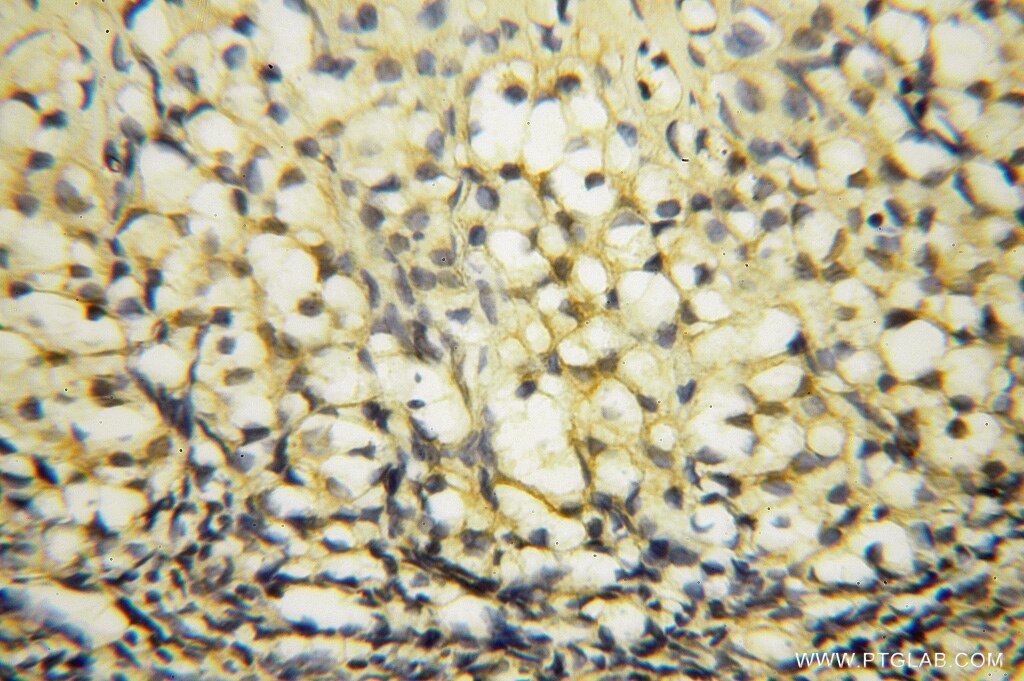 IHC staining of human ovary using 16762-1-AP