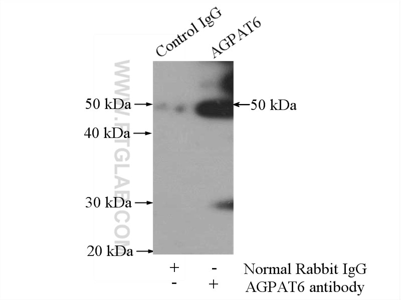 Immunoprecipitation (IP) experiment of mouse brain tissue using AGPAT6 Polyclonal antibody (16762-1-AP)