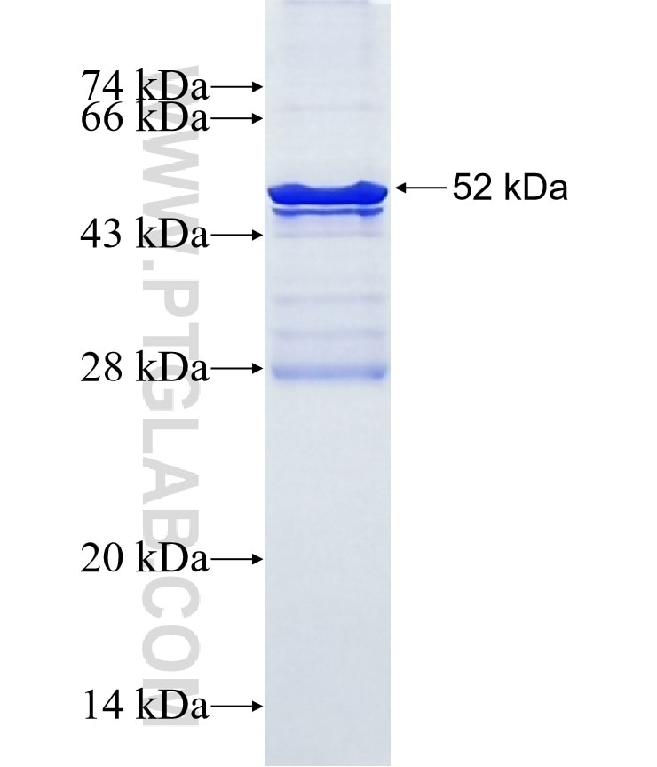 AGPAT6 fusion protein Ag10294 SDS-PAGE