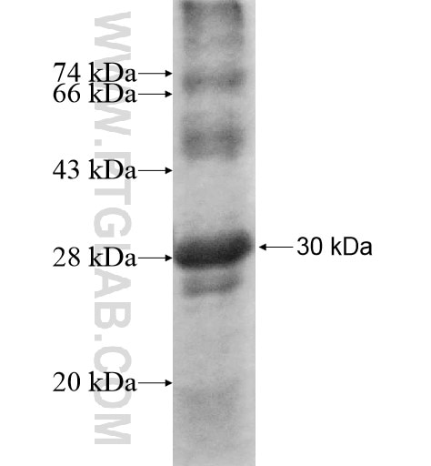 AGPAT6 fusion protein Ag10302 SDS-PAGE