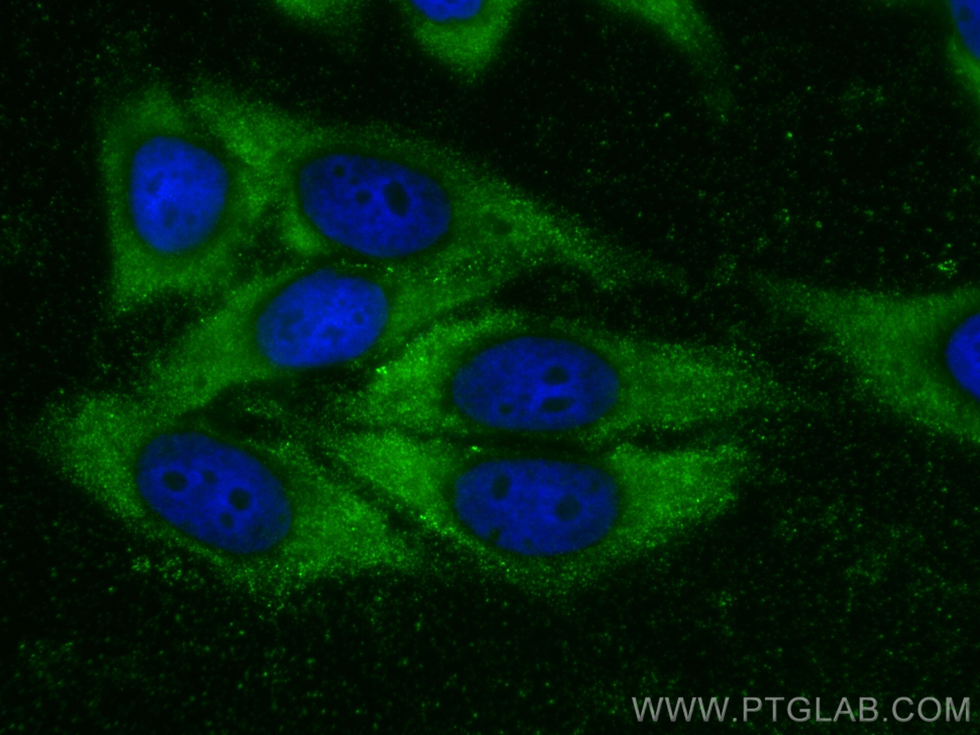 Immunofluorescence (IF) / fluorescent staining of HepG2 cells using AGPAT9 Polyclonal antibody (20603-1-AP)