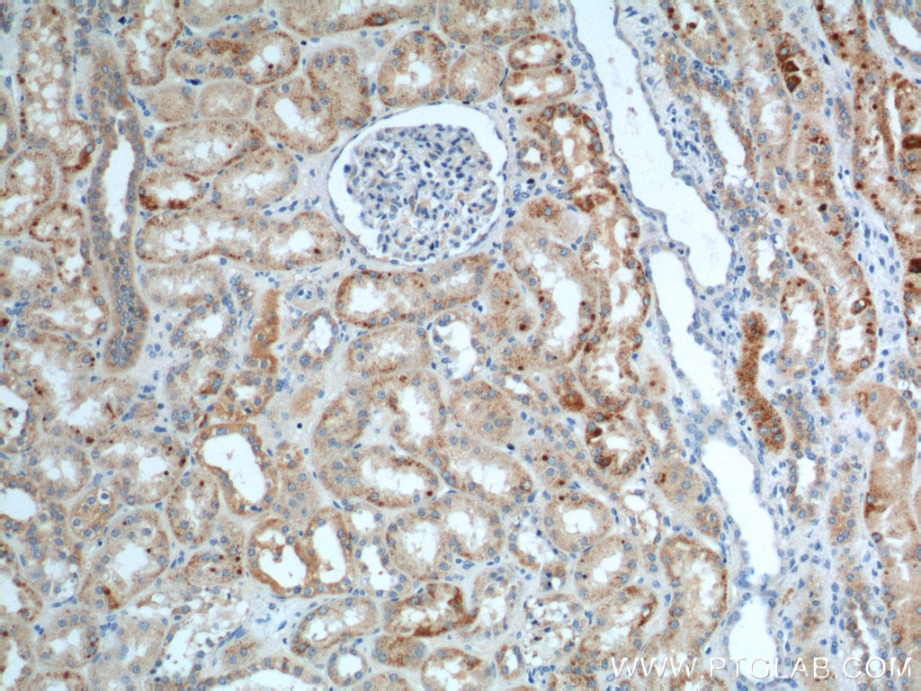 Immunohistochemistry (IHC) staining of human kidney tissue using AGPAT9 Polyclonal antibody (20603-1-AP)