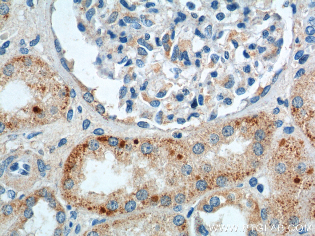 Immunohistochemistry (IHC) staining of human kidney tissue using AGPAT9 Polyclonal antibody (20603-1-AP)