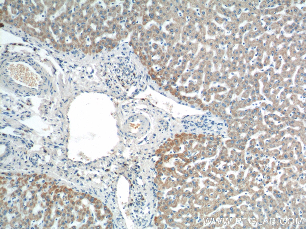 Immunohistochemistry (IHC) staining of human liver tissue using AGPAT9 Polyclonal antibody (20603-1-AP)