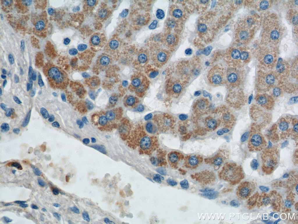 Immunohistochemistry (IHC) staining of human liver tissue using AGPAT9 Polyclonal antibody (20603-1-AP)