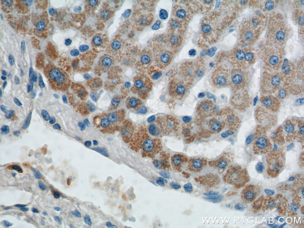 Immunohistochemistry (IHC) staining of human liver tissue using AGPAT9 Polyclonal antibody (20603-1-AP)