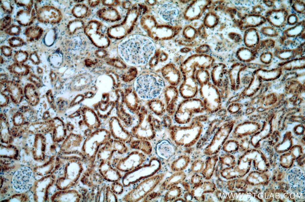 Immunohistochemistry (IHC) staining of human kidney tissue using AGPAT9 Polyclonal antibody (20603-1-AP)