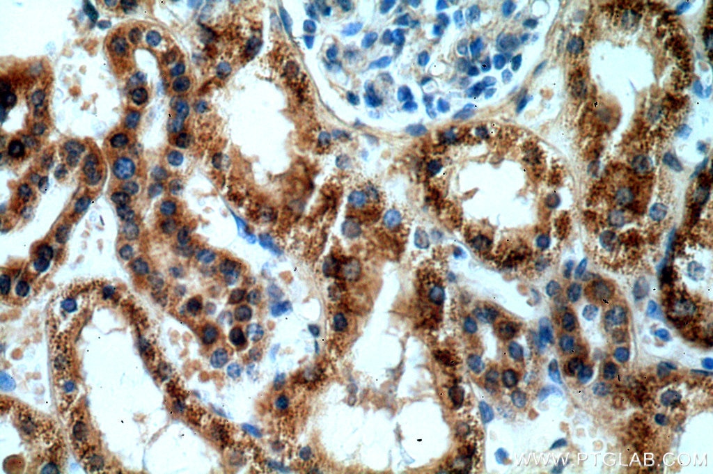 Immunohistochemistry (IHC) staining of human kidney tissue using AGPAT9 Polyclonal antibody (20603-1-AP)