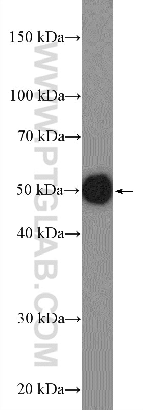 Western Blot (WB) analysis of rat kidney tissue using AGPAT9 Polyclonal antibody (20603-1-AP)