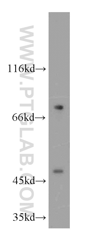 Western Blot (WB) analysis of HeLa cells using AGPAT9 Polyclonal antibody (20603-1-AP)