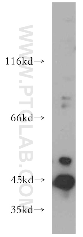 Western Blot (WB) analysis of HT-1080 cells using AGPAT9 Polyclonal antibody (20603-1-AP)