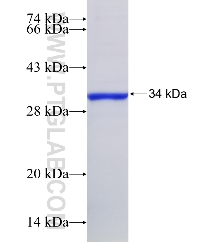 AGPAT9 fusion protein Ag14579 SDS-PAGE