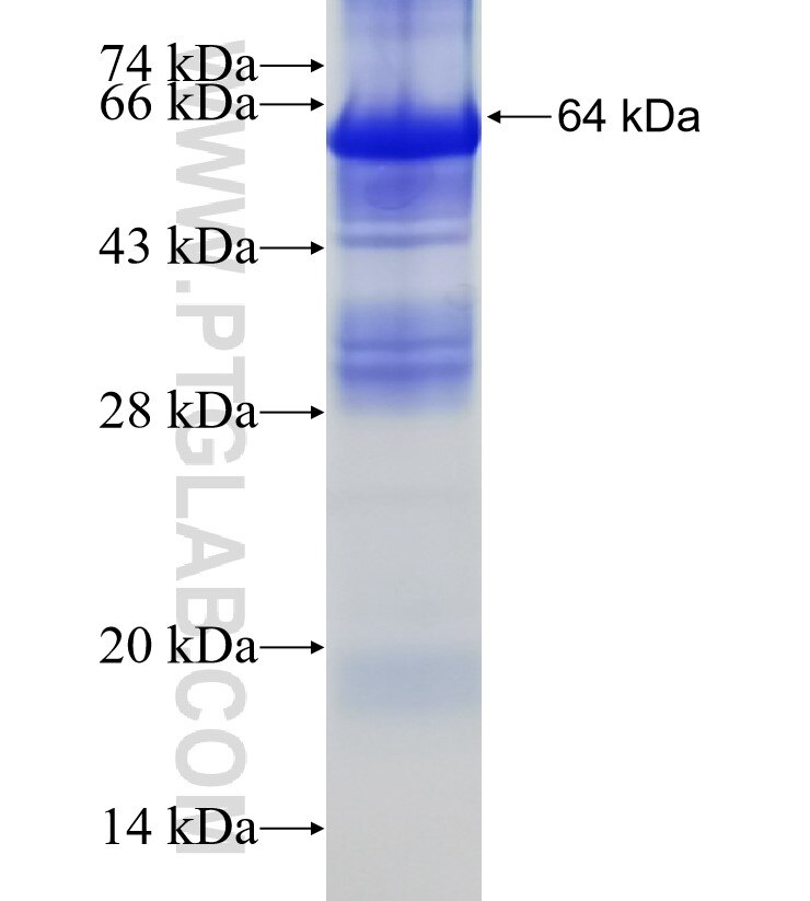 AGPS fusion protein Ag15233 SDS-PAGE