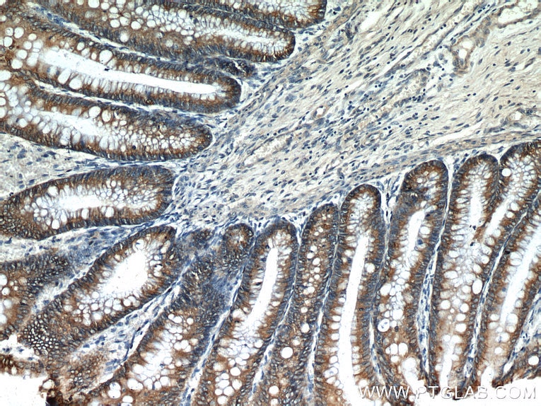 Immunohistochemistry (IHC) staining of human colon tissue using AGR2 Polyclonal antibody (12275-1-AP)