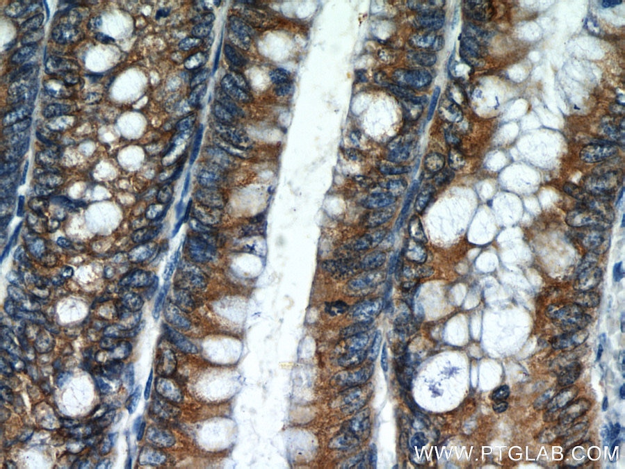 Immunohistochemistry (IHC) staining of human colon tissue using AGR2 Polyclonal antibody (12275-1-AP)