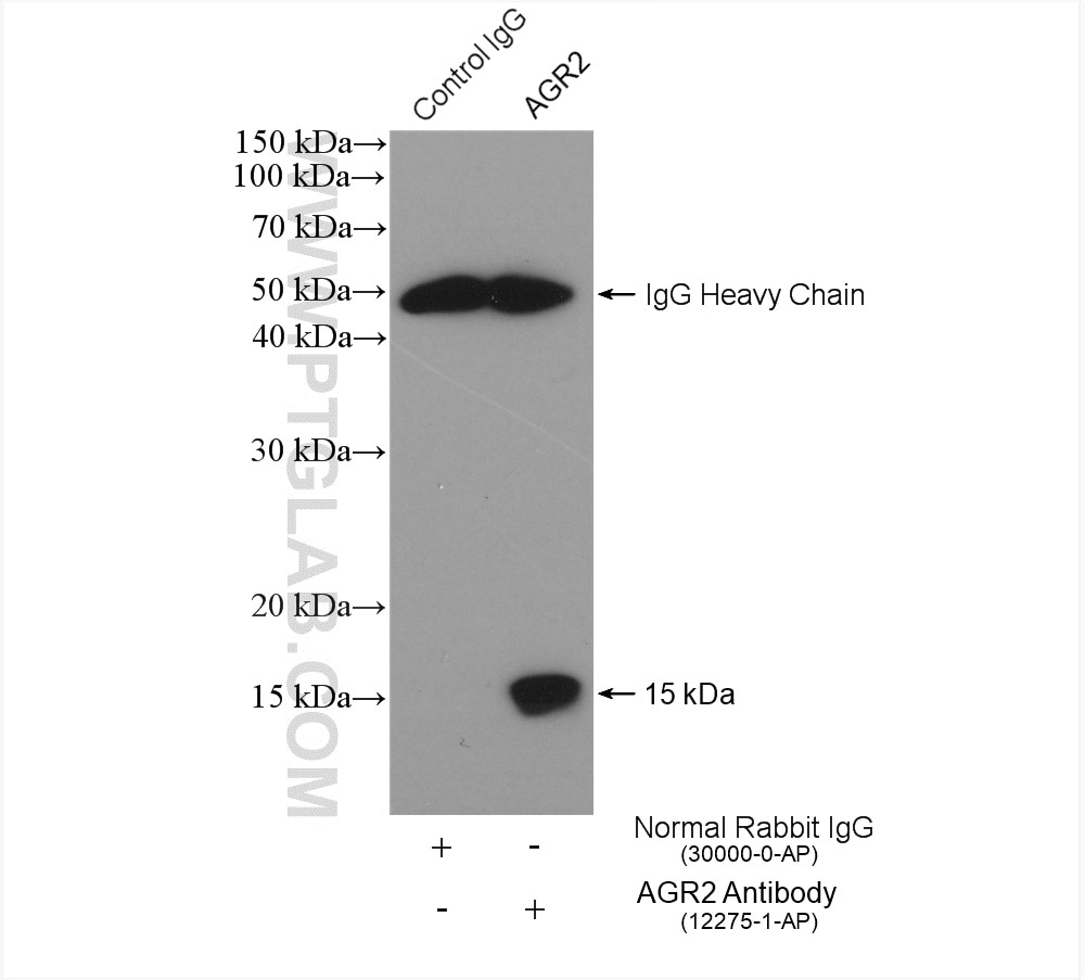 Immunoprecipitation (IP) experiment of A549 cells using AGR2 Polyclonal antibody (12275-1-AP)