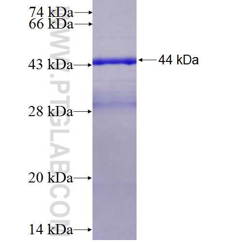 AGR2 fusion protein Ag2919 SDS-PAGE